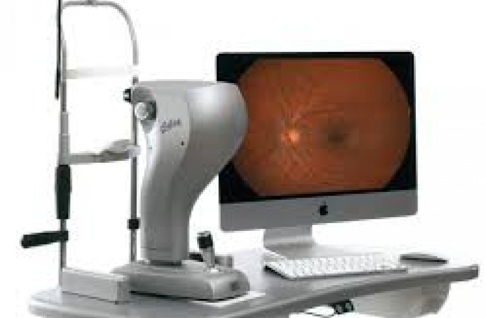 Foto retina con Fundus Camera non Midriatica Cobra