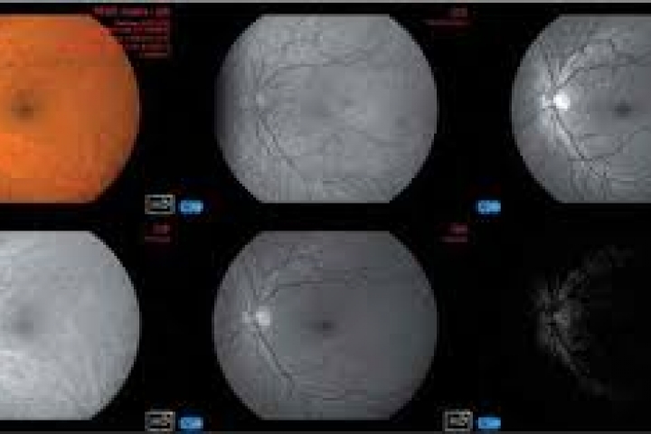 immagine 2 di Foto retina con Fundus Camera non Midriatica Cobra