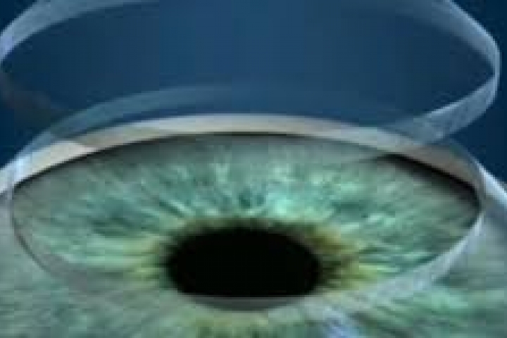 immagine 5 di Biomicroscopia Endoteliale Pachimetria studio della cornea