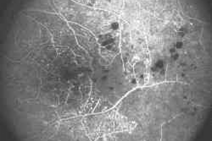 immagine 4 di Fluorangiografia Angiografia a Fluorescenza Digitale